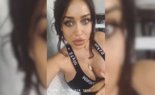 עוד ניתוח לאוסף - אביבית בר זוהר משנה את הפנים שלה